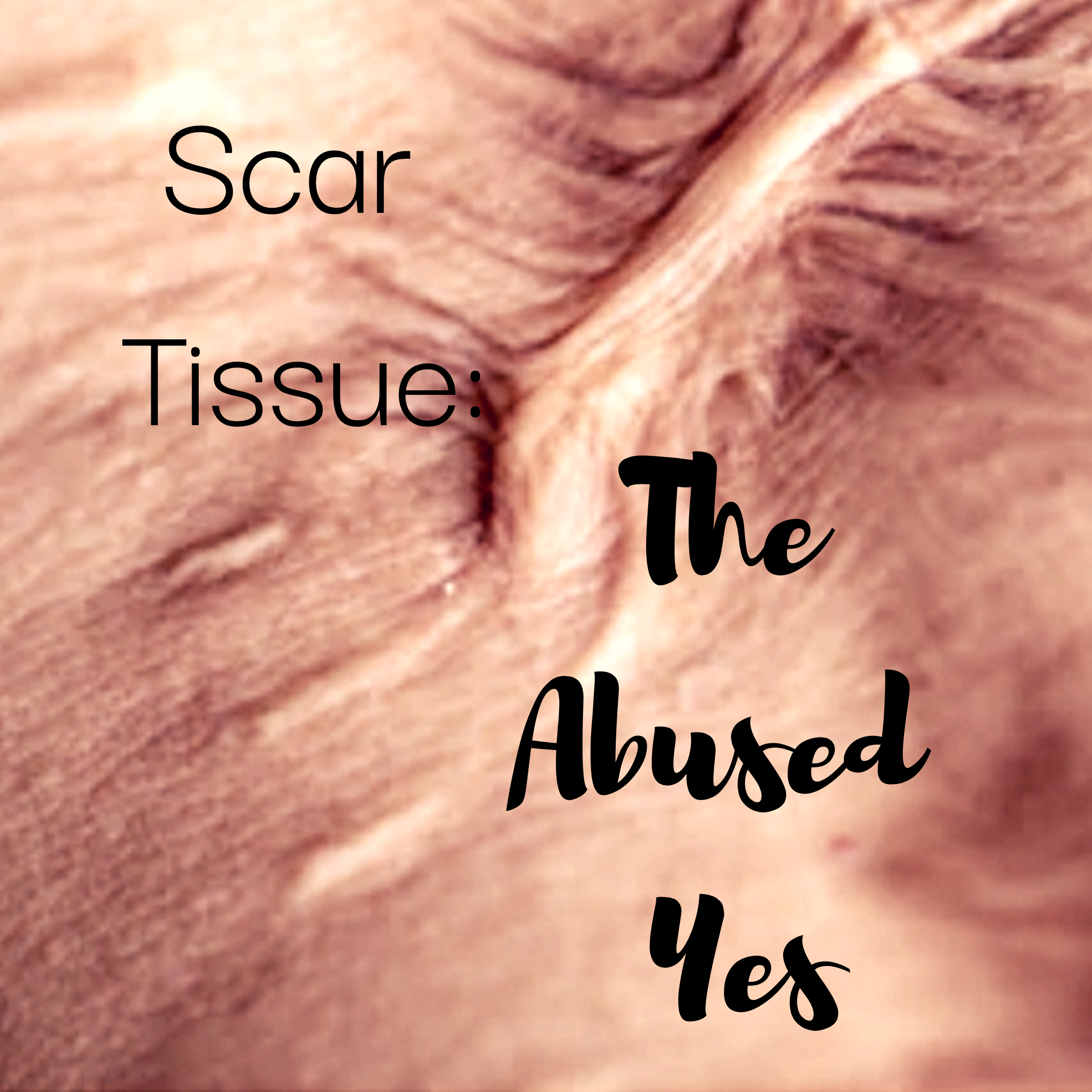 You are currently viewing Scar Tissue Pt. One: The Abused Yes
